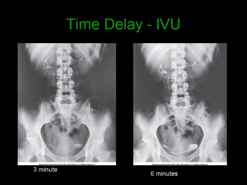 Time Delay - IVU 3 minute 6 minutes